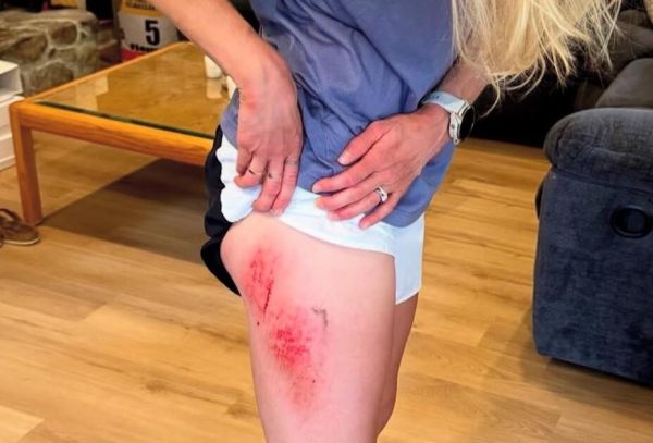 Elle se fait peur en tombant lors d'une séance de ski roues