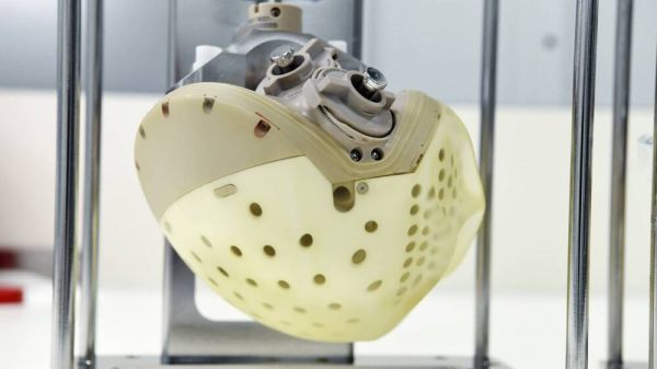 Carmat, le fabricant français d'un cœur artificiel temporaire, se déclare en cessation de paiements
