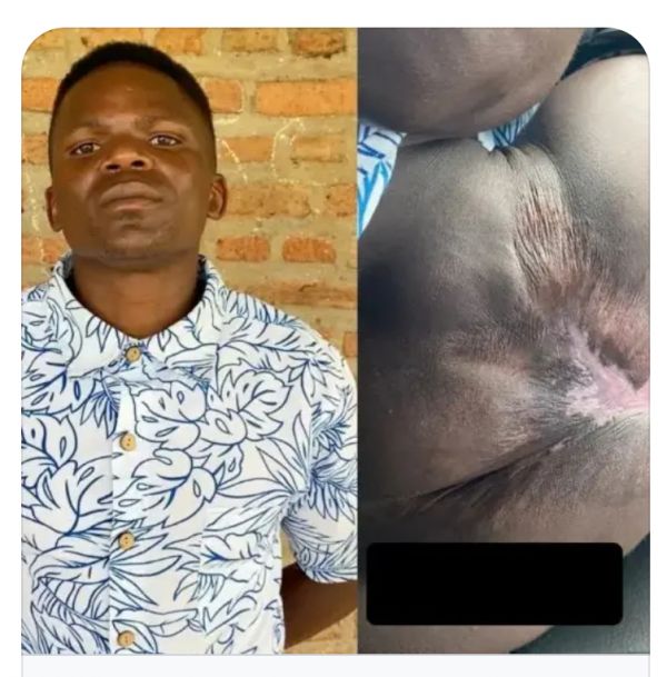 Rwanda – Des séquelles irréversibles : Emmanuel Ndagijimana, rescapé de la torture en prison, réclame justice et réparation