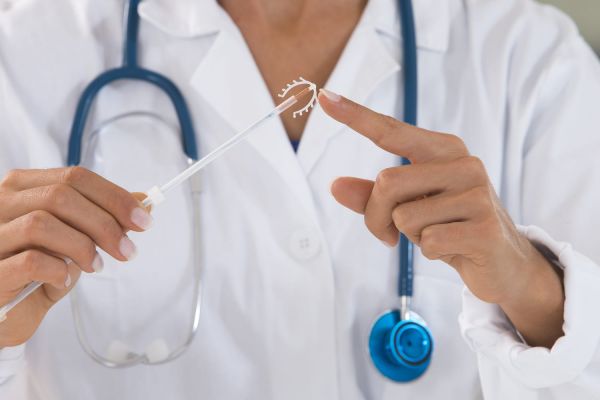 Stérilet au cuivre (DIU) : pose, fonctionnement, efficacité