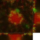 Résistance aux antibiotiques: le paradoxe des biofilms