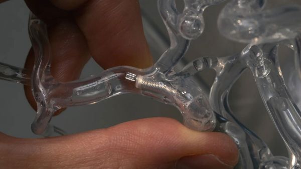 Des chercheurs de Stanford inventent un dispositif médical qui pourrait sauver des millions de vies