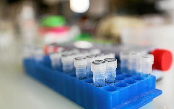 Contamination E. coli dans l'Aisne : 30 cas recensés, l'origine des intoxications précisée ce mercredi