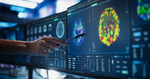 Une simple IRM cérébrale pourrait dire à quelle vitesse votre corps vieillit