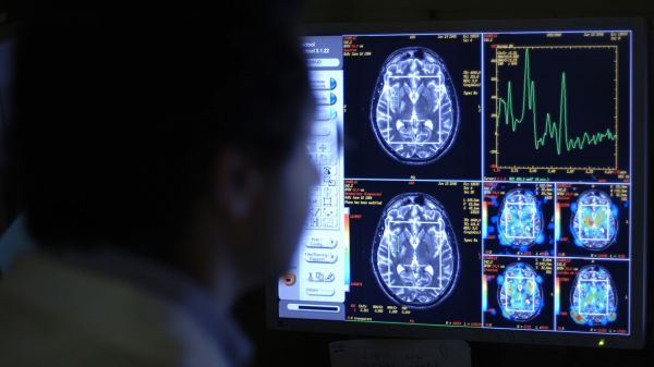 "Regarder des choses plus petites et aller plus vite" : une IRM ultrapuissante a été mise au point en France pour observer le cerveau des enfants