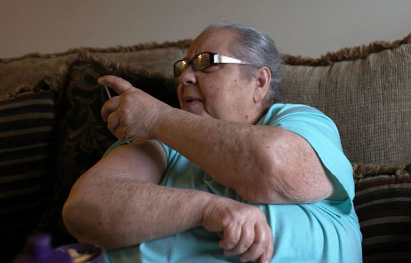 Des cellules souches auraient «guéri» des patients atteints d'un diabète de type 1