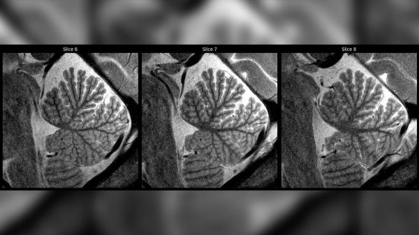 « Ces images sont pleines de promesses » : le cerveau des enfants dévoilé par une IRM surpuissante