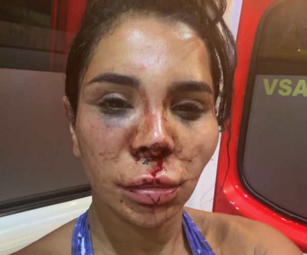 «Nous suspectons malheureusement qu'elle ait subi un viol» : une influenceuse victime d'un home-jacking à Marseille