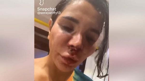 L’influenceuse franco-algérienne Soraya Riffy victime d’une agression d’une extrême violence à Marseille