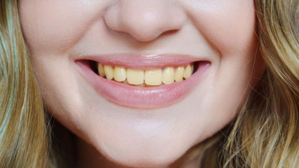 Les 6 raisons pour lesquelles vos dents deviennent jaunes et comment y mettre un terme