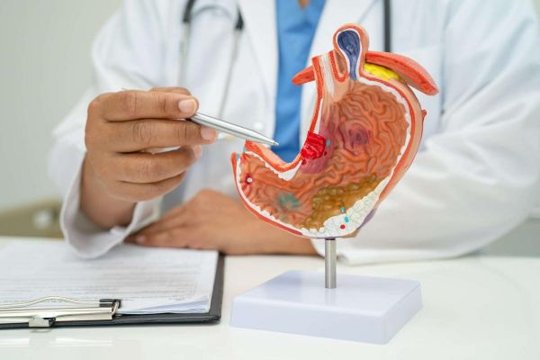 Cancers gastriques : un meilleur dépistage, une urgence mondiale