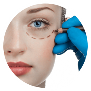 Blepharoplastie Tunisie : Chirurgie esthetique des paupieres
