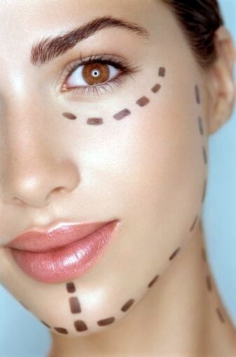 Les cicatrices du lifting du visage - clinique hannibal