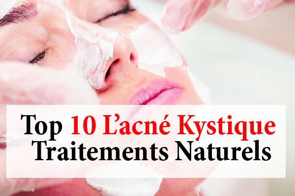 10 L'acné kystique traitements naturels - justefemmes