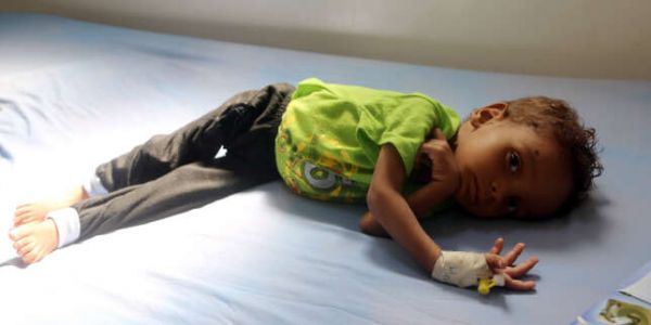 Yémen : plus de 5 millions d'enfants menacés de famine
