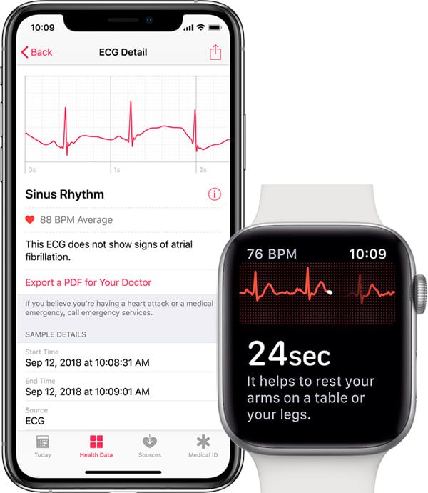 Peut-on activer la mesure d'électro cardiogramme sur l'Apple Watch Séries 4 en dehors des US ?