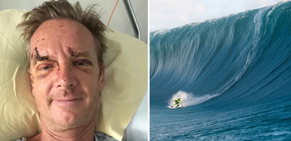 Le photographe de surf Tim Mckenna opéré après un accident à Paris