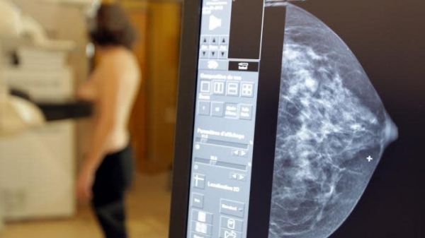 Nouveau dépistage du cancer du sein : "On a des chances majeures que ça marche", se réjouit l'oncologue Suzette Delaloge