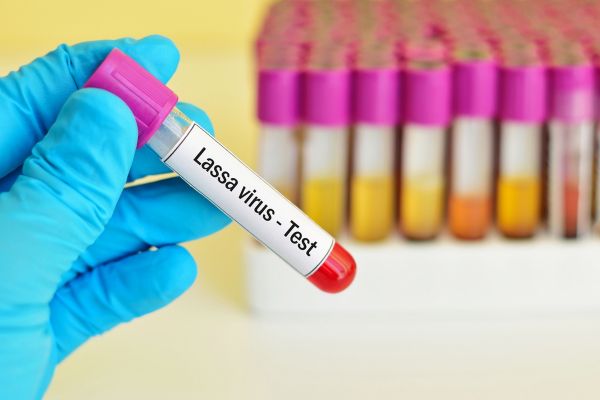 Bientôt un vaccin contre la fièvre de Lassa ?