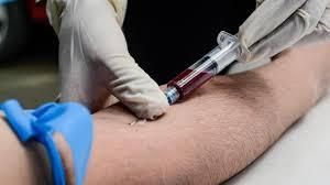 "Les tests sérologiques ne sont pas homologués" alerte l'agence régionale de santé