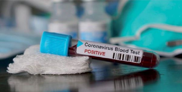 Coronavirus: 45 nouveaux cas confirmés au Maroc, 7.967 au total