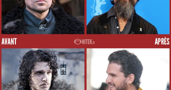Avant/Après : que sont devenus les acteurs de Game of Thrones en 2024 ?