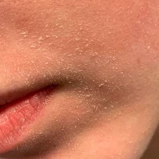 Les 15 Meilleurs Produits Naturels pour Hydrater sa Peau en Profondeur.