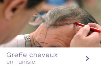greffe cheveux tunisie : tarifs avantageux à la clinique Pasteur