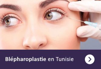 Chirurgie visage Tunisie - tarifs tout compris - qualité et sécurité