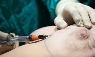 Lipofilling seins Tunisie