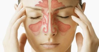 Comment soigner la sinusite d'une manière naturelle?