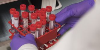 Dépistage du cancer du col de l'utérus : le test viral à faire d'abord