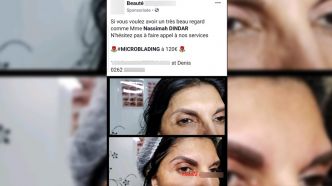 (Pierrot Dupuy) Quand Nassimah se met en scène en train de se faire refaire les sourcils...