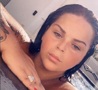 Sarah Fraisou succombe une nouvelle fois à la chirurgie esthétique