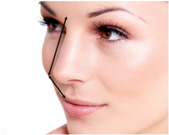 Chirurgie esthétique du nez ou rhinoplastie Tunisie : docteur nizar mahjoub