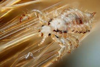 5 remèdes naturels pour lutter contre les poux