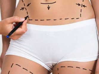 Meilleures cliniques de Liposuccion en Turquie