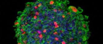 Coronavirus : Que sait-on vraiment du nouveau variant "Omicron" détecté en Afrique du Sud et qui a déjà fait son entrée en Europe par la Belgique ? Vidéo