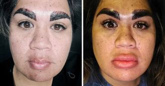 Une femme sous le choc après une séance de microblading des sourcils qui a mal tourné