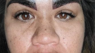 "C'est horrible!": Le nouveau visage de cette femme après un microblading qui tourne mal