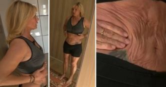 Laure regrette sa liposuccion réalisée en Tunisie: "J'en pleure tous les jours”