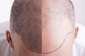 Quelle est la différence entre Dermopigmentation, Microblading, Maquillage Permanent et Semi Permanent ?
