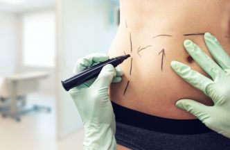 Avant/après liposuccion : Lucile, 32 ans, « je pleurais souvent devant le miroir avant de m'habiller »
