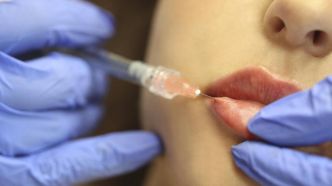 Les injections: des techniques de médecine esthétique à la mode