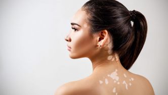 Tâches cutanées en tout genre