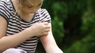 Les 10 meilleurs produits pour ne plus se gratter après des piqûres de moustiques et araignées