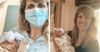 Amour sans limite : Karla Brun adopte une enfant atteinte d’ichtyose, offrant une famille et des soins spéciaux
