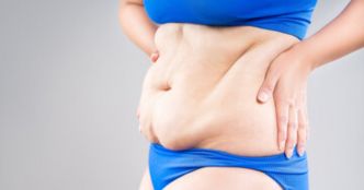 Comment enlever le tablier du ventre sans chirurgie ?
