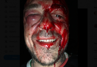 Italie : le présentateur et ex-rugbyman Gabriele Rubini tabassé par des milices juives
