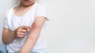 Le cauchemar des allergies alimentaires chez les enfants: «une épée de Damoclès constante» sur la tête des parents